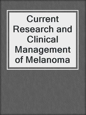 Current Research and Clinical Management of Melanoma