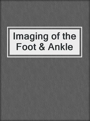 Imaging of the Foot & Ankle