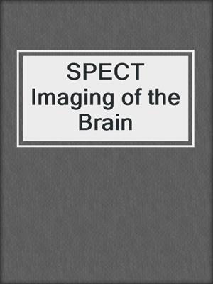 SPECT Imaging of the Brain